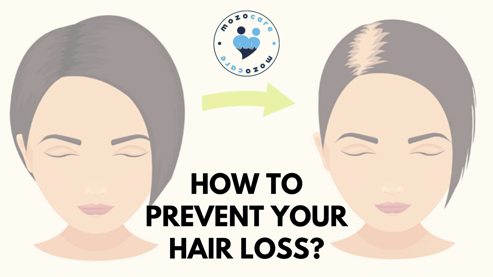 How To Prevent Your Hair Loss?