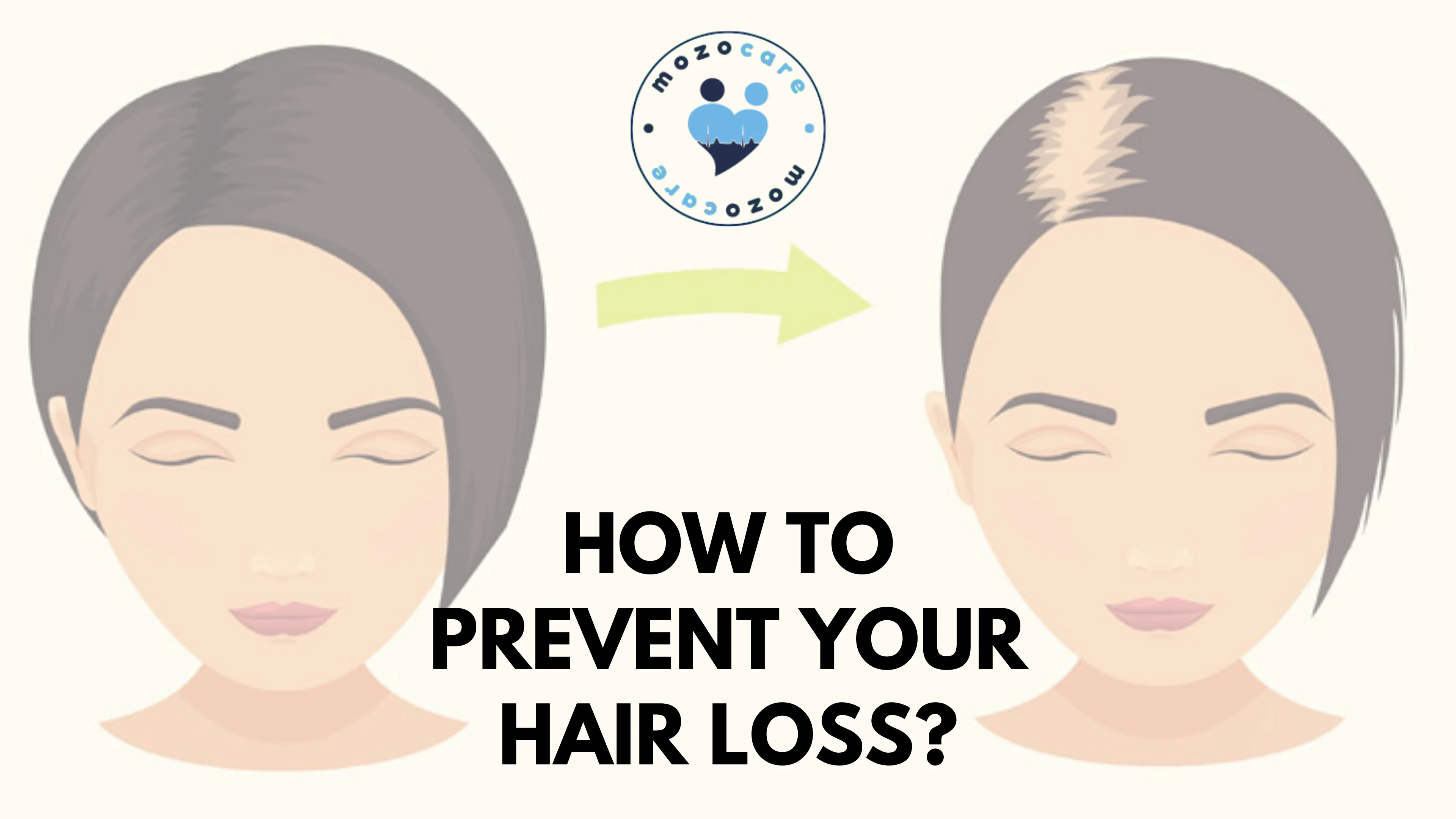 How To Prevent Your Hair Loss?