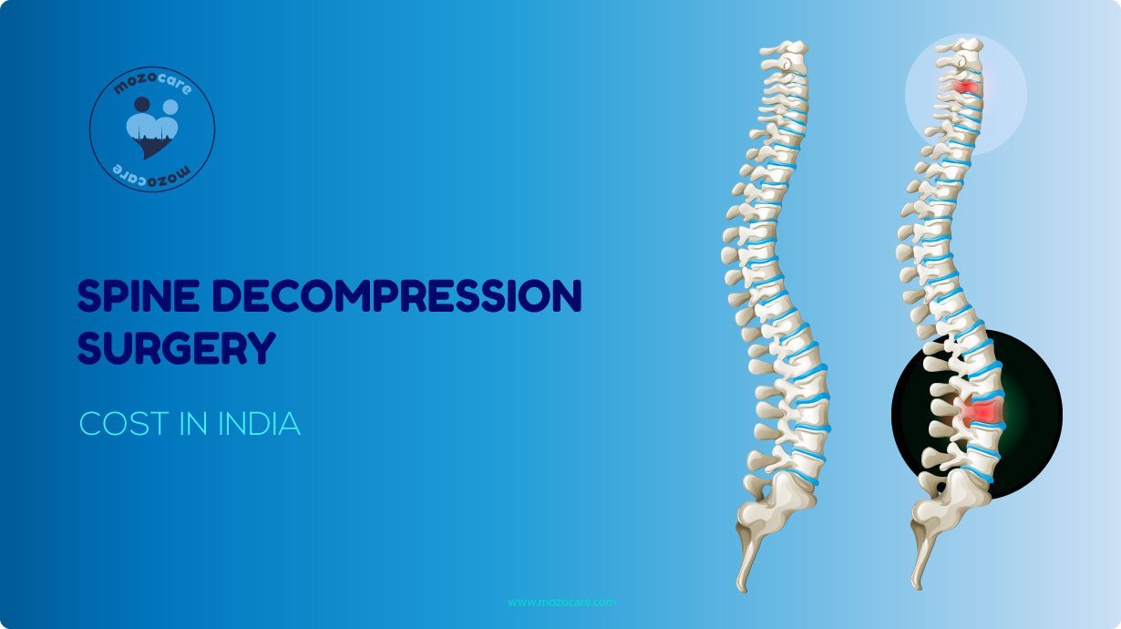 Spine Decompression Surgery