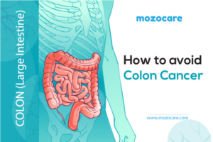 How To Avoid Colon Cancer | Mozocare Insights