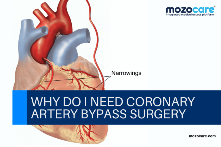 Coronary Artery Bypass